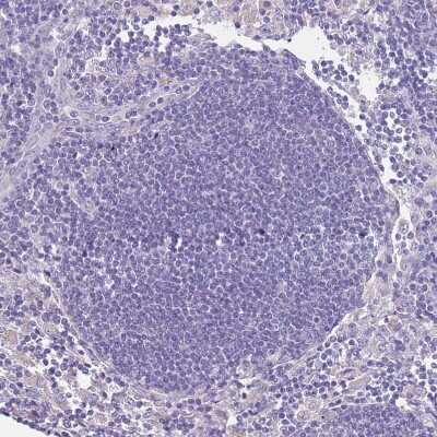 Immunohistochemistry-Paraffin: RHCG Antibody [NBP2-30905] - Staining of human Lymph node shows no membranous positivity in non-germinal center cells as expected.