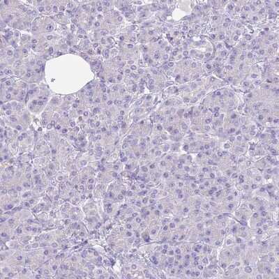 Immunohistochemistry-Paraffin: RHCG Antibody [NBP2-30905] - Staining of human Pancreas shows no membranous positivity in exocrine glandular cells as expected.