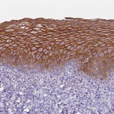 Immunohistochemistry-Paraffin: RHCG Antibody [NBP2-30905] - Staining of human Tonsil shows strong membranous positivity in squamous epithelial cells.