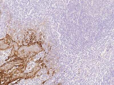 Immunohistochemistry-Paraffin: RHCG Antibody [NBP2-97617] - Immunochemical staining of human RHCG in human esophagus with rabbit polyclonal antibody at 1:200 dilution, formalin-fixed paraffin embedded sections.