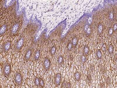 Immunohistochemistry-Paraffin: RHCG Antibody [NBP2-97617] - Immunochemical staining of human RHCG in human esophagus with rabbit polyclonal antibody at 1:200 dilution, formalin-fixed paraffin embedded sections.