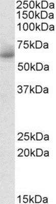 Western Blot: RHCG Antibody [NBP1-52089] - Analysis of RHCG Human Testis lysate (35ug protein in RIPA buffer) using NBP1-52089 at 1ug/ml. Primary incubation was 1 hour. Detected by chemiluminescence.