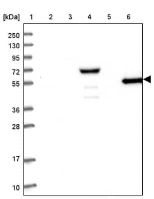 Western Blot: RHCG Antibody [NBP2-30905] - Lane 1: Marker  [kDa] 250, 130, 95, 72, 55, 36, 28, 17, 10.  Lane 2: Human cell line RT-4.  Lane 3: Human cell line U-251MG sp.  Lane 4: Human plasma (IgG/HSA depleted).  Lane 5: Human liver tissue.  Lane 6: Human tonsil tissue