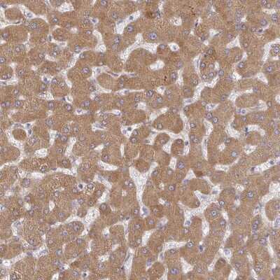 Immunohistochemistry-Paraffin: RHEBL1 Antibody [NBP2-33674] - Staining of human liver shows moderate cytoplasmic positivity in hepatocytes.