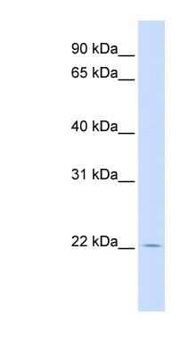 Western Blot: RHEBL1 Antibody [NBP1-58891] - Titration: 0.2-1 ug/ml, Positive Control: Human Muscle.