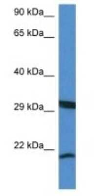 Western Blot: RHEBL1 Antibody [NBP1-74160] - Mouse Kidney lysate, concentration 1 ug/ml.