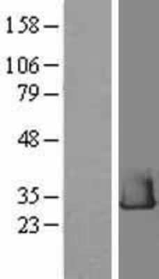 Western Blot: RHEBL1 Overexpression Lysate (Adult Normal) [NBL1-15347] Left-Empty vector transfected control cell lysate (HEK293 cell lysate); Right -Over-expression Lysate for RHEBL1.