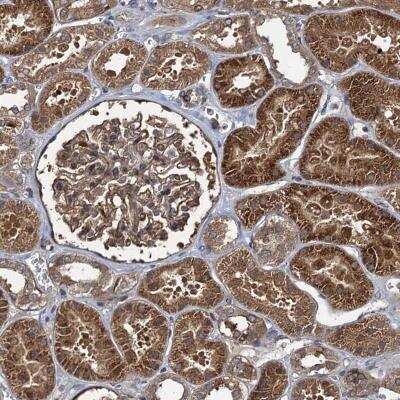 Immunohistochemistry: RHOBTB1 Antibody [NBP1-81485] - Staining of human kidney shows strong cytoplasmic positivity in cells in tubules and in glomeruli