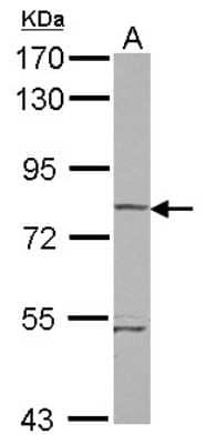 Western Blot: RHOBTB1 Antibody [NBP2-20155] - Sample (30 ug of whole cell lysate) A: A431 7. 5% SDS PAGE gel, diluted at 1:5000.