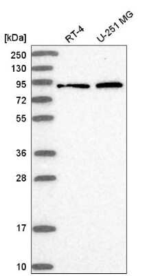 Western Blot: RHOBTB1 Antibody [NBP2-55210] - Western blot analysis in human cell line RT-4 and human cell line U-251 MG.