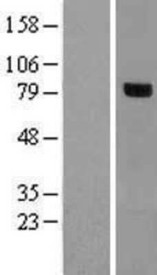 Western Blot: RHOBTB1 Overexpression Lysate (Adult Normal) [NBP2-09181] Left-Empty vector transfected control cell lysate (HEK293 cell lysate); Right -Over-expression Lysate for RHOBTB1.