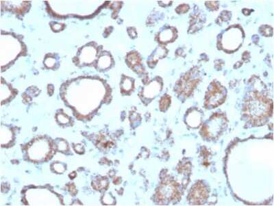 Immunohistochemistry-Paraffin: RHOBTB2 Antibody (DBC2/3362) [NBP3-08659] - Formalin-fixed, paraffin-embedded human thyroid stained with RHOBTB2 Mouse Monoclonal Antibody (RHOBTB2/3362).