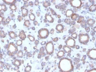 Immunohistochemistry-Paraffin: RHOBTB2 Antibody (DBC2/3364) [NBP3-08806] - Formalin-fixed, paraffin-embedded human thyroid stained with RHOBTB2 Mouse Monoclonal Antibody (RHOBTB2/3364).