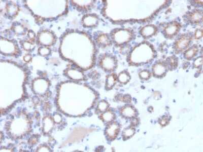 Immunohistochemistry-Paraffin: RHOBTB2 Antibody (DBC2/3364) [NBP3-08806] - Formalin-fixed, paraffin-embedded human thyroid stained with RHOBTB2 Mouse Monoclonal Antibody (RHOBTB2/3364).