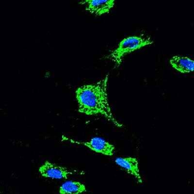 Immunocytochemistry/Immunofluorescence: RHOT2 Antibody [H00089941-B01P] - Human endometrial stromal cells stained with RHOT2 antibody (green). Image from verified customer review.