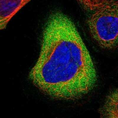 Immunocytochemistry/Immunofluorescence: RHOT2 Antibody [NBP1-88981] - Immunofluorescent staining of human cell line A-431 shows localization to cytosol.