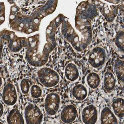 Immunohistochemistry-Paraffin: RHOT2 Antibody [NBP1-88981] - Staining of human small intestine shows cytoplasmic positivity in glandular cells.