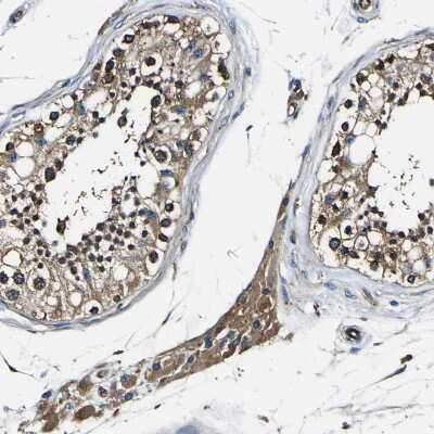 Immunohistochemistry-Paraffin: RHOT2 Antibody [NBP1-88981] - Staining of human testis shows cytoplasmic positivity.