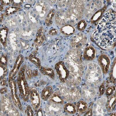 Immunohistochemistry-Paraffin: RHOT2 Antibody [NBP1-88981] - Staining of human kidney shows cytoplasmic positivity in cells in tubules.