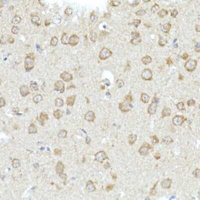 Immunohistochemistry-Paraffin: RHOT2 Antibody [NBP2-93326] - Immunohistochemistry of paraffin-embedded mouse brain using RHOT2 Rabbit pAb (NBP2-93326) at dilution of 1:50 (40x lens). Perform high pressure antigen retrieval with 10 mM citrate buffer pH 6.0 before commencing with IHC staining protocol.