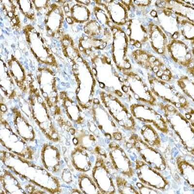 Immunohistochemistry-Paraffin: RHOT2 Antibody [NBP2-93326] - Immunohistochemistry of paraffin-embedded rat kidney using RHOT2 Rabbit pAb (NBP2-93326) at dilution of 1:50 (40x lens). Perform high pressure antigen retrieval with 10 mM citrate buffer pH 6.0 before commencing with IHC staining protocol.