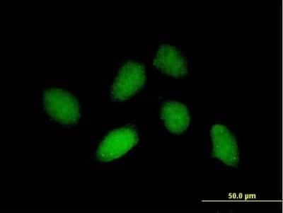 Immunocytochemistry/ Immunofluorescence RHOXF1 Antibody - Azide and BSA Free
