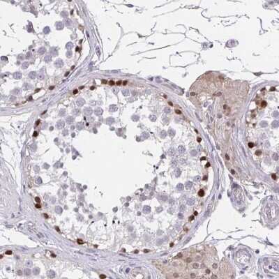 Immunohistochemistry-Paraffin RHOXF1 Antibody - BSA Free