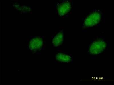 Immunocytochemistry/Immunofluorescence: RHOXF2 Antibody [H00084528-B02P] - Analysis of purified antibody to PEPP-2 on HeLa cell. (antibody concentration 10 ug/ml)