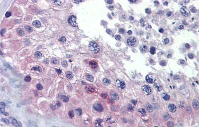 Immunohistochemistry: RHOXF2 Antibody [NBP3-10457] - Immunohistochemical analysis of human testis.