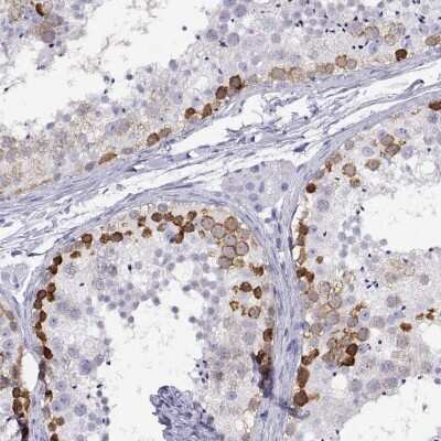 Immunohistochemistry-Paraffin: RHOXF2 Antibody [NBP1-84364] - Staining of human testis shows strong cytoplasmic positivity in cells in seminiferous ducts.