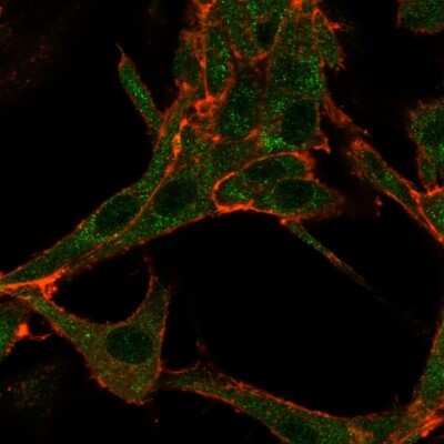 Immunocytochemistry/Immunofluorescence: RHOXF2 Antibody (PCRP-RHOXF2-1D7) [NBP3-07401] - Immunofluorescence Analysis of HeLa cells using RHOXF2 Mouse Monoclonal Antibody (PCRP-RHOXF2-1D7) followed by goat anti- Mouse IgG-CF488 (green). CF640A phalloidin (red).