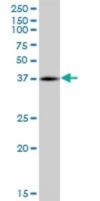 Western Blot: RHOXF2 Antibody [H00084528-B01P] - Analysis of PEPP-2 expression in K-562.