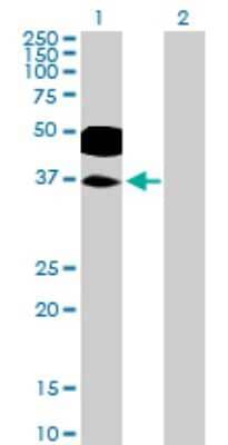 Western Blot: RHOXF2 Antibody [H00084528-B01P] - Analysis of RHOXF2 expression in transfected 293T cell line by RHOXF2 polyclonal antibody.  Lane 1: PEPP-2 transfected lysate(31.79 KDa). Lane 2: Non-transfected lysate.