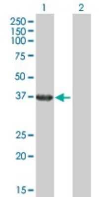 Western Blot: RHOXF2 Antibody [H00084528-B02P] - Analysis of RHOXF2 expression in transfected 293T cell line by RHOXF2 polyclonal antibody.  Lane 1: PEPP-2 transfected lysate(31.68 KDa). Lane 2: Non-transfected lysate.