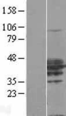 Western Blot: RHOXF2 Overexpression Lysate (Adult Normal) [NBL1-15362] Left-Empty vector transfected control cell lysate (HEK293 cell lysate); Right -Over-expression Lysate for RHOXF2.