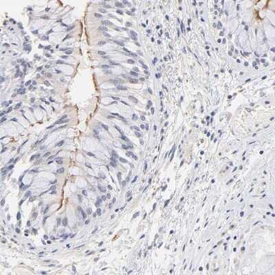 Immunohistochemistry-Paraffin: RIBC2 Antibody [NBP1-86814] - Staining of human bronchus shows moderate positivity in cilia in respiratory epithelial cells.