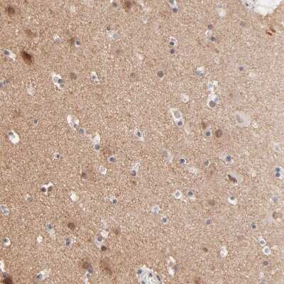 Immunohistochemistry-Paraffin: RIBC2 Antibody [NBP1-86814] - Staining of human cerebral cortex shows moderate positivity in neuropil.