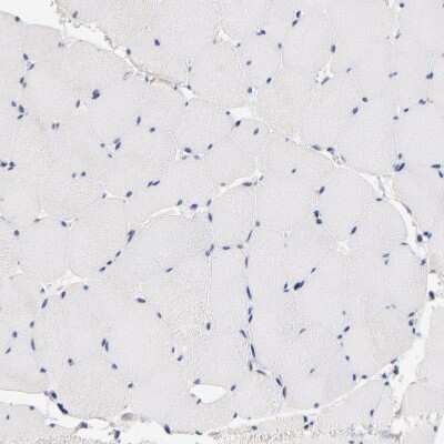 Immunohistochemistry-Paraffin: RIBC2 Antibody [NBP1-86814] - Staining of human skeletal muscle shows no positivity in myocytes as expected.