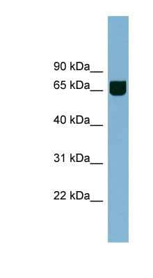 Western Blot: RIC8 Antibody [NBP1-56877] - Jurkat cell lysate, concentration 0.2-1 ug/ml.