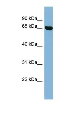 Western Blot: RIC8 Antibody [NBP1-56878] - Human Placenta lysate, concentration 0.2-1 ug/ml.