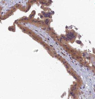 Immunohistochemistry-Paraffin: RIC8B Antibody [NBP2-13232] - Staning of human fallopian tube shows moderate to strong cytoplasmic positivity in granular layer. 