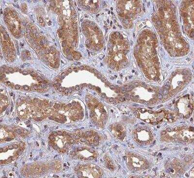 Immunohistochemistry-Paraffin: RIC8B Antibody [NBP2-13232] - Staining of human kidney shows moderate to strong cytoplasmic positivity in granular layer. 