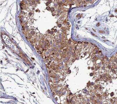 Immunohistochemistry-Paraffin: RIC8B Antibody [NBP2-13232] - Staining of human testis shows moderate to strong cytoplasmic positivity in seminiferous ducts.  