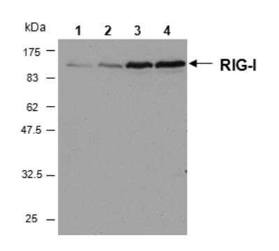 Western Blot: RIG-I Antibody (Alme-1) [NBP2-80055] - Analysis of human RIG-I in HeLa cells by using RIG-I, mAb (Alme-1). Cell extracts from HeLa cells either unstimulated (lane 1) or stimulated for 6h (lane 2), 16h (lane 3) or 24 h (lane 4) with Interferon gamma were resolved by SDS-PAGE under reducing conditions, transferred to nitrocellulose and incubated with the RIG-I , mAb (Alme-1) at a 1:1000 dilution for 1 hour. Proteins were visualized using a peroxidase-conjugated polyclonal antibody to mouse IgG and a chemiluminescence detection system.