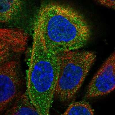 Immunocytochemistry/Immunofluorescence: RIG-I Antibody [NBP2-55599] - Staining of human cell line A-431 shows localization to cytosol.