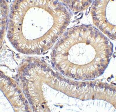 Immunohistochemistry: RIG-I Antibody [NBP1-76732] - Immunohistochemistry of RIG-I in mouse testis tissue with RIG-I Antibody NBP1-76732 at 1 ug/mL.