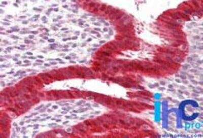 Immunohistochemistry-Paraffin: RIG-I Antibody [NBP2-27419] -  Formalin-fixed, paraffin-embedded human uterus stained with RIG-I antibody at 10 ug/ml.