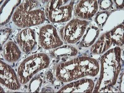Immunohistochemistry: RIG-I Antibody (OTI6C1) - Azide and BSA Free [NBP2-73909] - Analysis of Human Kidney tissue. (Heat-induced epitope retrieval by 10mM citric buffer, pH6.0, 120C for 3min)