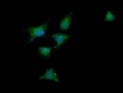 Immunocytochemistry/Immunofluorescence: RIG-I Antibody (OTI6C1) [NBP2-45678] - Analysis  of COS7 cells transiently transfected by pCMV6-ENTRY RIG-I.