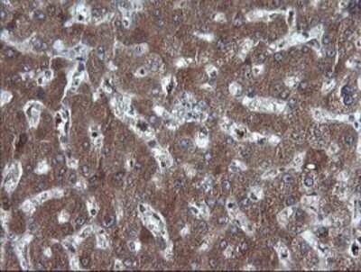 Immunohistochemistry: RIG-I Antibody (OTI6C1) [NBP2-45678] - Analysis of Human liver tissue. (Heat-induced epitope retrieval by 10mM citric buffer, pH6.0, 120C for 3min)